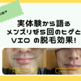 【知恵袋より】メンズリゼ5回で足りない、効果ないって本当？ヒゲやVIOは熱破壊式？体験者が語る真実