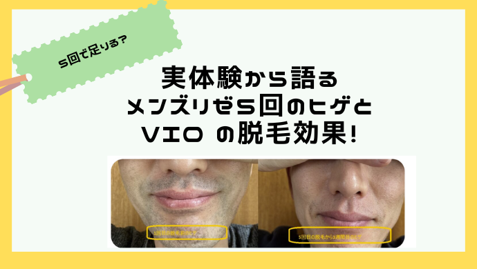 【知恵袋より】メンズリゼ5回で足りない、効果ないって本当？ヒゲやVIOは熱破壊式？体験者が語る真実