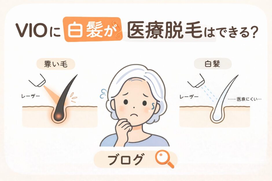 VIOに白髪があると医療脱毛はできる？仕組み・注意点・介護脱毛との関係を解説